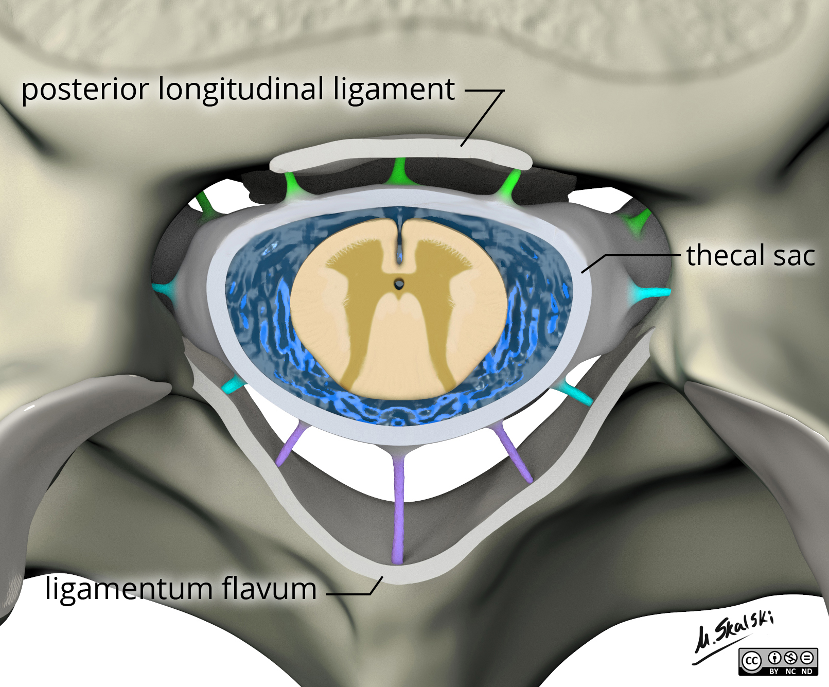 Radiopaedia Drawing Ligamentum flavum, posterior longitudinal